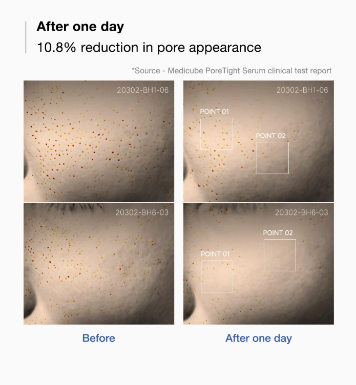 Serum - MEDICUBE Zero Pore One-day