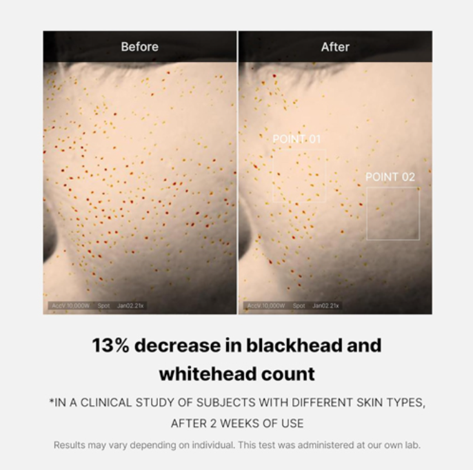 Serum - MEDICUBE Zero Pore One-day