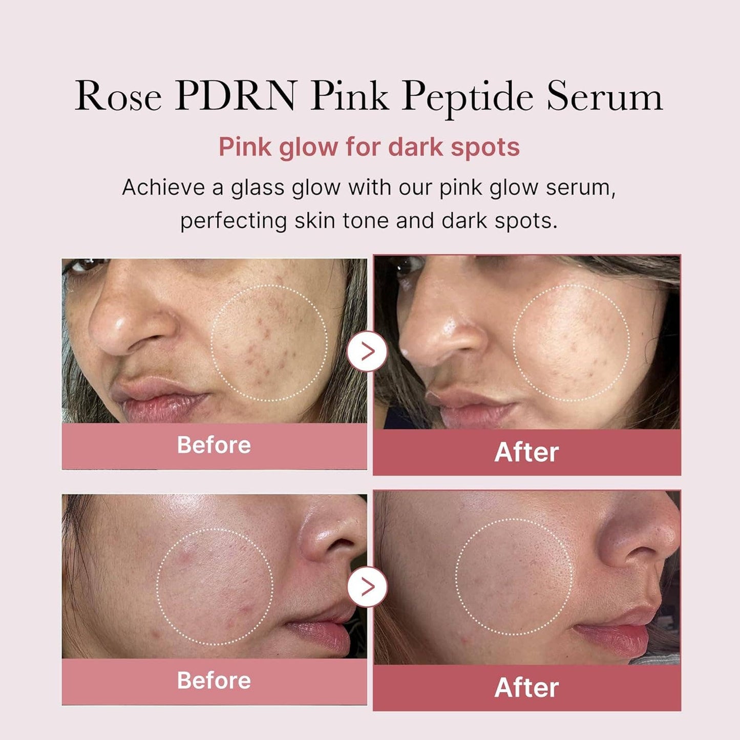 Serum - MEDICUBE PDRN Pink Peptide 30ML